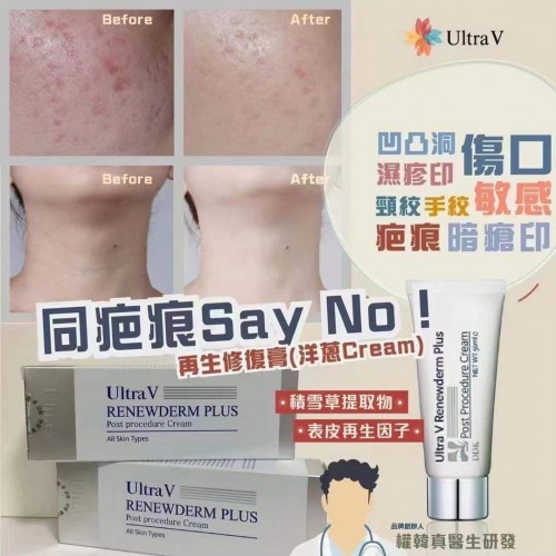 20220827韓國Ultra V 洋蔥再生修復膏 (50ml) 
